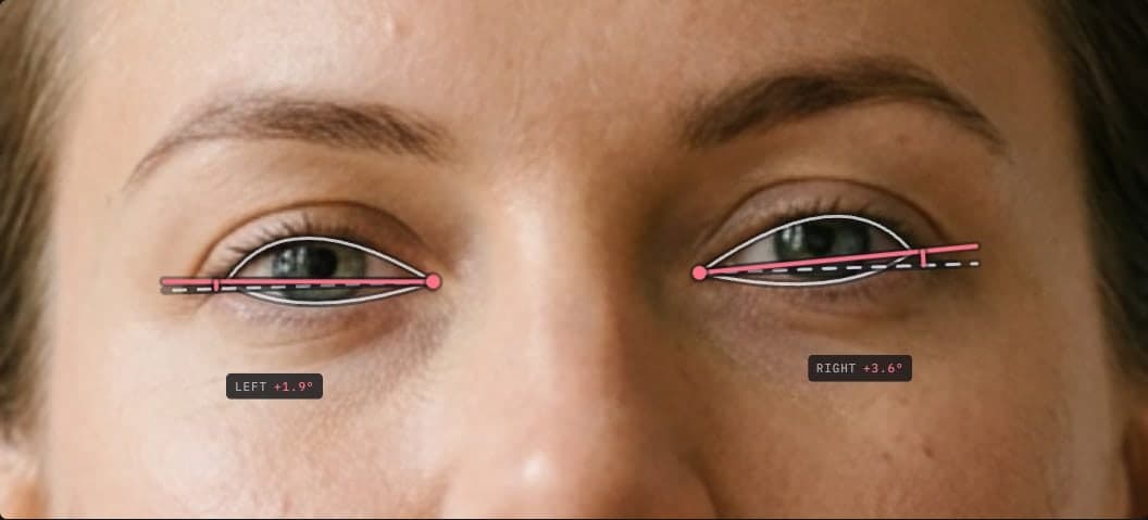 Canthal tilt test example: a close crop of both eyes with the line from inner to outer corner drawn against a level reference, reading plus 1.9 degrees on the left eye and plus 3.6 degrees on the right