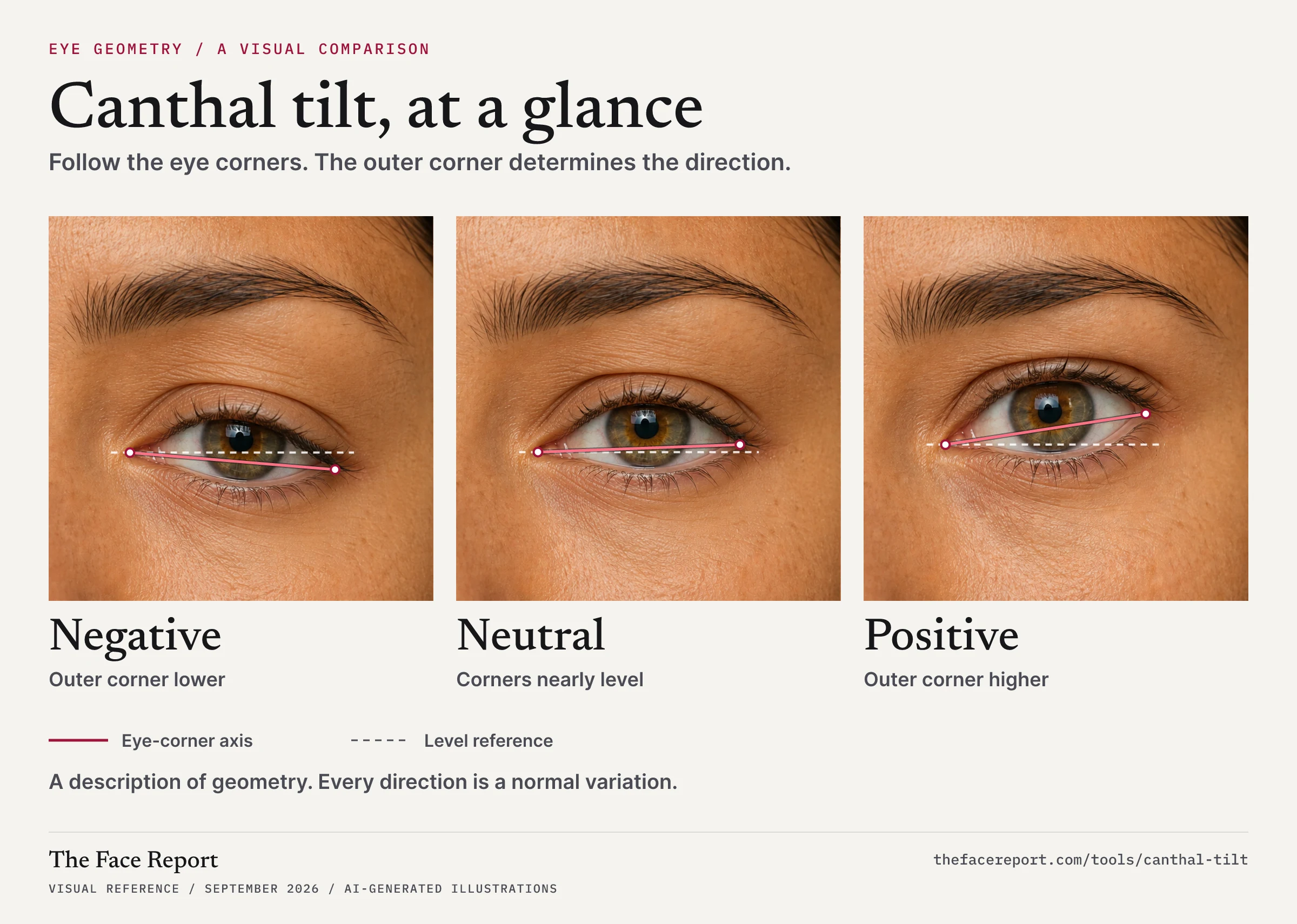 Canthal tilt comparison chart: three illustrated eye close-ups show negative tilt with the outer corner lower, neutral tilt with corners nearly level, and positive tilt with the outer corner higher. Lines mark the eye-corner axis and level reference.