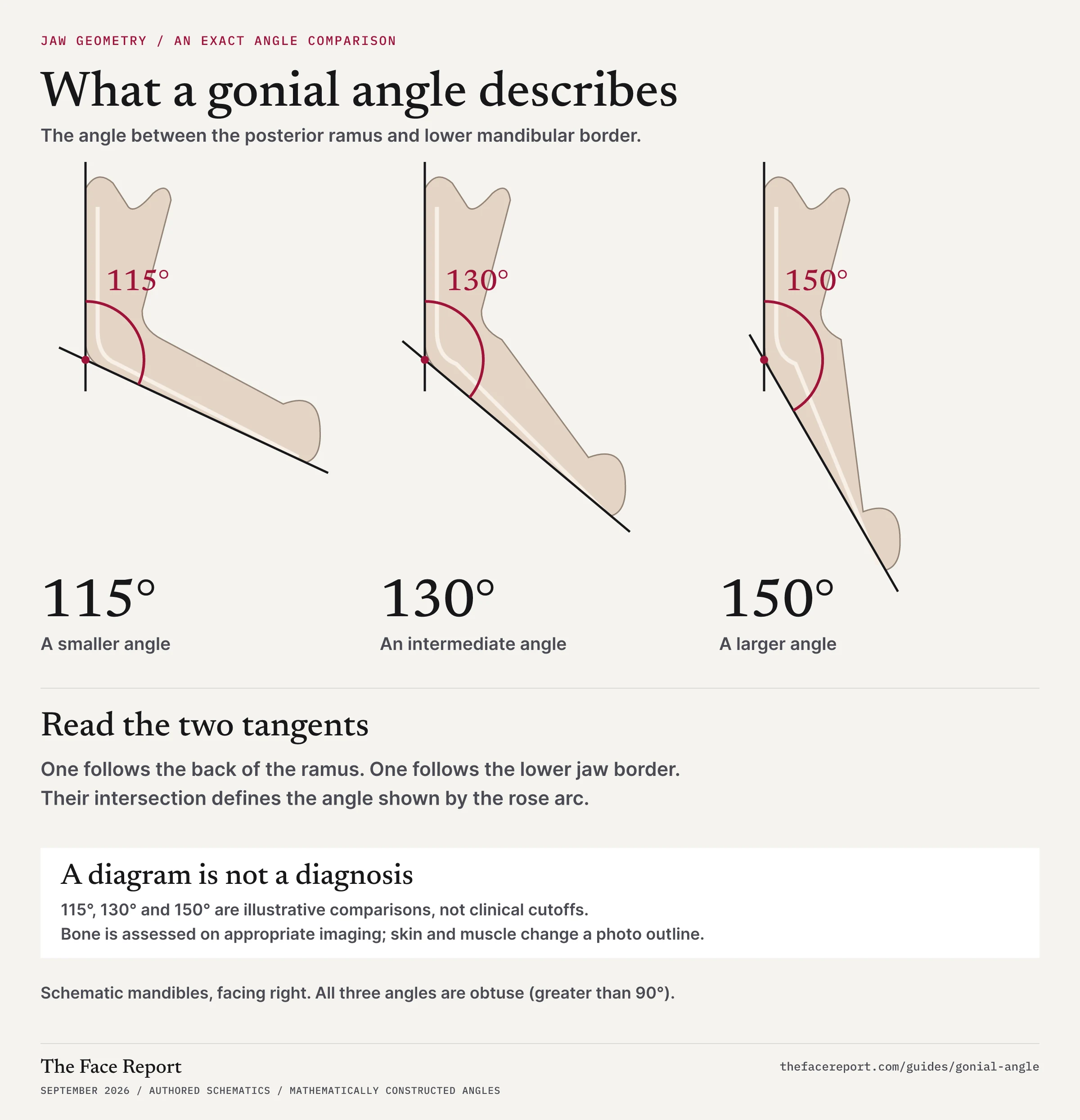 Gonial-angle comparison showing 115, 130 and 150 degree angles on schematic mandibles. Dark lines follow the posterior ramus and lower mandibular border; rose arcs mark the interior angles. The values are examples, not clinical cutoffs.